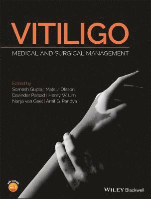 Somesh Gupta, Mats J Olsson, Davinder Parsad, Henry W Lim, Nanja van Geel, Amit G Pandya - Vitiligo, Inbunden