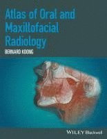 bokomslag Atlas of Oral and Maxillofacial Radiology