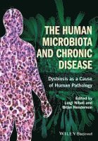 Luigi Nibali, Brian Henderson, UK) Nibali, Luigi (Queen Mary University London, London, UK) Henderson, Brian (Eastman Dental Institute, University College London - Human Microbiota and Chronic Disease, Inbunden