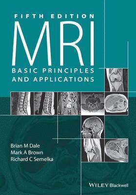 Brian M. Dale, Mark A. Brown, Richard C. Semelka - MRI, Häftad