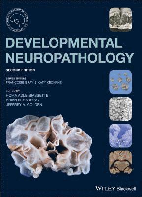 bokomslag Developmental Neuropathology