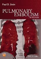 bokomslag Pulmonary Embolism