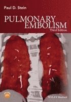 bokomslag Pulmonary Embolism