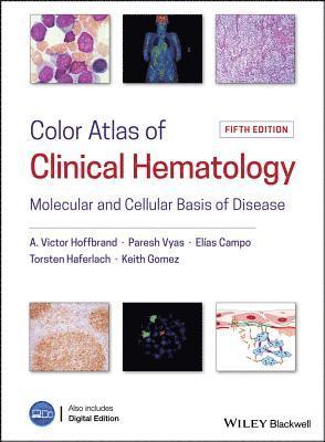 A. Victor Hoffbrand, Paresh Vyas, Elias Campo, Torsten Haferlach, Keith Gomez - Color Atlas of Clinical Hematology, Inbunden
