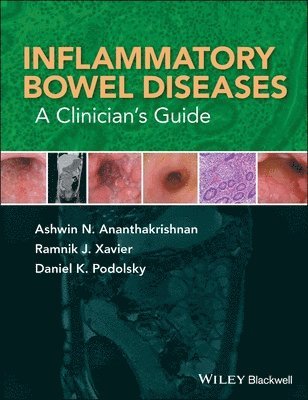 bokomslag Inflammatory Bowel Diseases