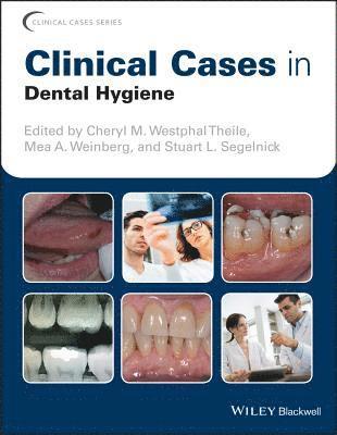 Clinical Cases in Dental Hygiene 1