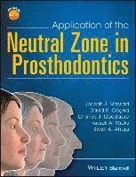bokomslag Application of the Neutral Zone in Prosthodontics