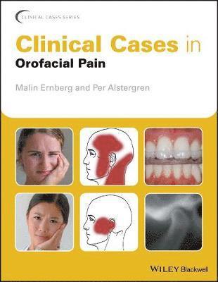 Malin Ernberg, Per Alstergren, Sweden) Ernberg, Malin (Karolinska Institutet, Sweden) Alstergren, Per (Malmo University - Clinical Cases in Orofacial Pain, Häftad