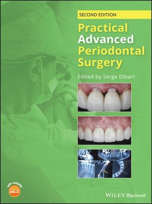 bokomslag Practical Advanced Periodontal Surgery