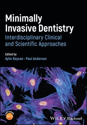 Aylin Baysan, Paul Anderson, Aylin Baysan, Paul Anderson, UK) Baysan, Aylin (Queen Mary University of London, UK) Anderson, Paul (Queen Mary University of London - Minimally Invasive Dentistry, Häftad