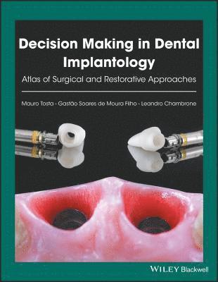 Decision Making in Dental Implantology 1