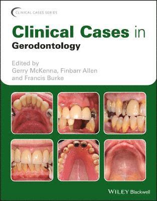 Clinical Cases in Gerodontology 1
