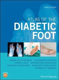 bokomslag Atlas of the Diabetic Foot
