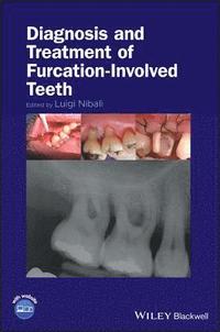 bokomslag Diagnosis and Treatment of Furcation-Involved Teeth