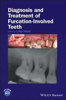 bokomslag Diagnosis and Treatment of Furcation-Involved Teeth