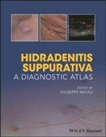 bokomslag Hidradenitis Suppurativa