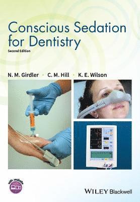 Conscious Sedation for Dentistry 1
