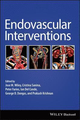 Endovascular Interventions 1