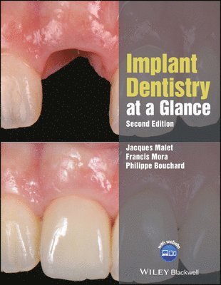 Jacques Malet, Francis Mora, Philippe Bouchard - Implant Dentistry at a Glance, Häftad