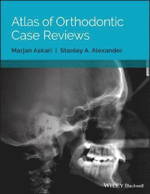 Atlas of Orthodontic Case Reviews 1