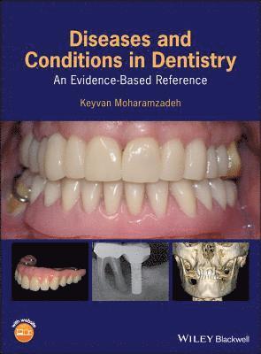 bokomslag Diseases and Conditions in Dentistry