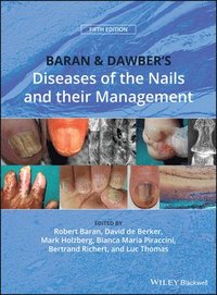 bokomslag Baran and Dawber's Diseases of the Nails and their Management