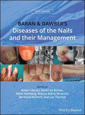 Robert Baran, David A. R. de Berker, Mark Holzberg, Bianca Maria Piraccini, Bertrand Richert, Luc Thomas - Baran and Dawber's Diseases of the Nails and their Management, Inbunden