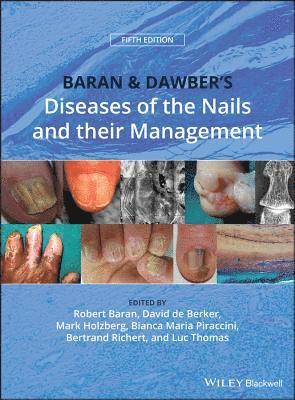 bokomslag Baran and Dawber's Diseases of the Nails and their Management