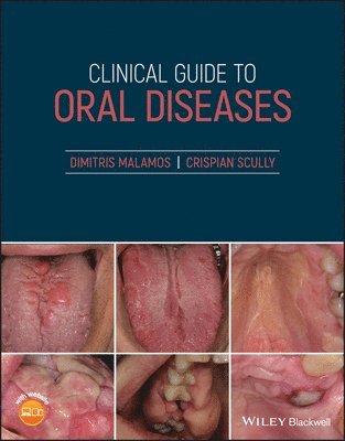Dimitris Malamos, Crispian Scully - Clinical Guide to Oral Diseases, Häftad