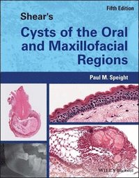bokomslag Shear's Cysts of the Oral and Maxillofacial Regions