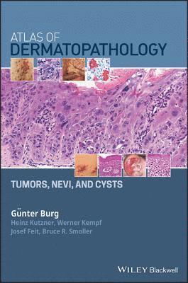 Günter Burg, Heinz Kutzner, Werner Kempf, Josef Feit, Bruce R. Smoller - Atlas of Dermatopathology, Inbunden
