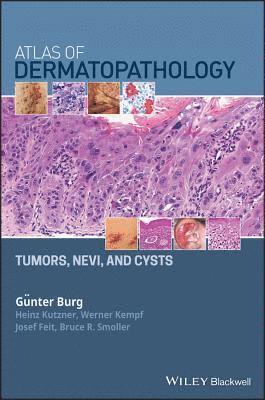 Atlas of Dermatopathology 1