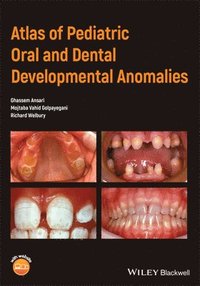 bokomslag Atlas of Pediatric Oral and Dental Developmental Anomalies