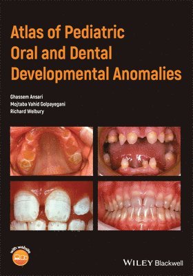 Ghassem Ansari, Mojtaba Vahid Golpayegani, Richard Welbury - Atlas of Pediatric Oral and Dental Developmental Anomalies, Häftad