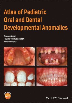 Atlas of Pediatric Oral and Dental Developmental Anomalies 1