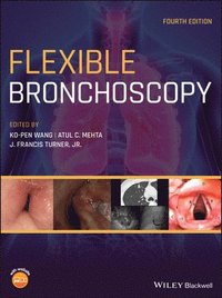 bokomslag Flexible Bronchoscopy