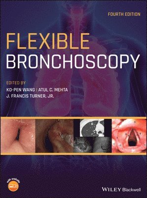 Ko-Pen Wang, Atul C. Mehta, J. Francis Turner Jr. - Flexible Bronchoscopy, Inbunden