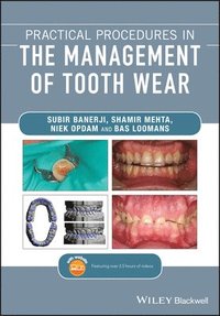 bokomslag Practical Procedures in the Management of Tooth Wear