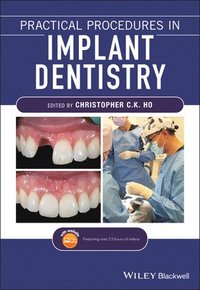 bokomslag Practical Procedures in Implant Dentistry