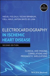 bokomslag Electrocardiography in Ischemic Heart Disease