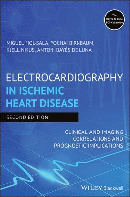 Electrocardiography in Ischemic Heart Disease 1