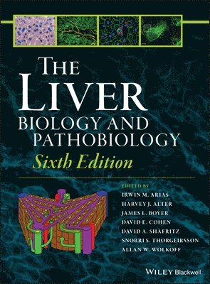 Irwin M. Arias, Harvey J. Alter, James L. Boyer, David E. Cohen, David A. Shafritz, Snorri S. Thorgeirsson, Allan W. Wolkoff, USA) Arias, Irwin M. (National Institutes of Health, Bethesda, Maryland, USA) Alter, Harvey J. (National Institutes of Health, Bethesda, Maryland, USA) Boyer, James L. (Yale University School of Medicine, New Haven, USA) Cohen, David E. (Brigham and Women's Hospital, Boston, USA) Shafritz, David A. (Albert Einstein College of Medicine, Bronx, NY, USA) Wolkoff, Allan W. (Albert Einstein College of Medicine, Bronx, NY, Irwin M Arias, Harvey J Alter, James L Boyer, David E Cohen, David A Shafritz, Snorri S Thorgeirsson, Allan W Wolkoff - Liver, Inbunden