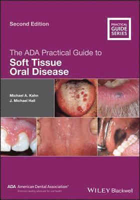 Michael A. Kahn, J. Michael Hall - ADA Practical Guide to Soft Tissue Oral Disease, Häftad