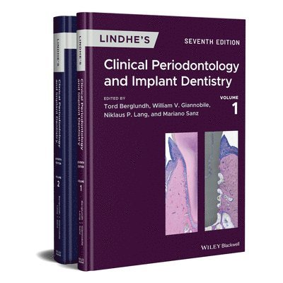 Lindhe's Clinical Periodontology and Implant Dentistry, 2 Volume Set 1