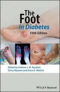bokomslag The Foot in Diabetes