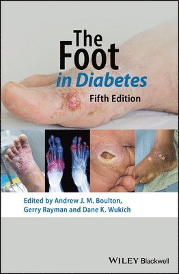 The Foot in Diabetes 1