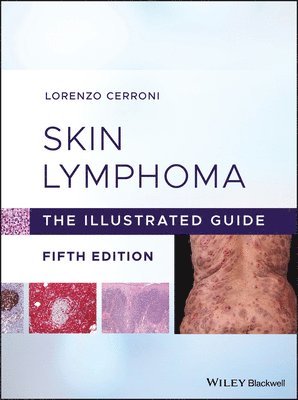 bokomslag Skin Lymphoma