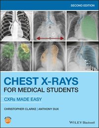 bokomslag Chest X-Rays for Medical Students