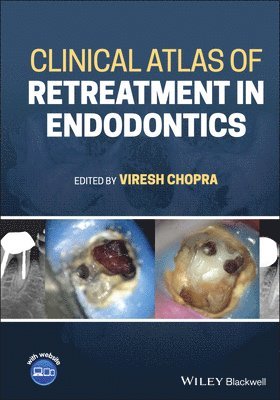 bokomslag Clinical Atlas of Retreatment in Endodontics