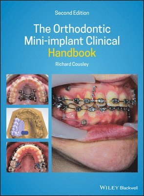 bokomslag The Orthodontic Mini-implant Clinical Handbook